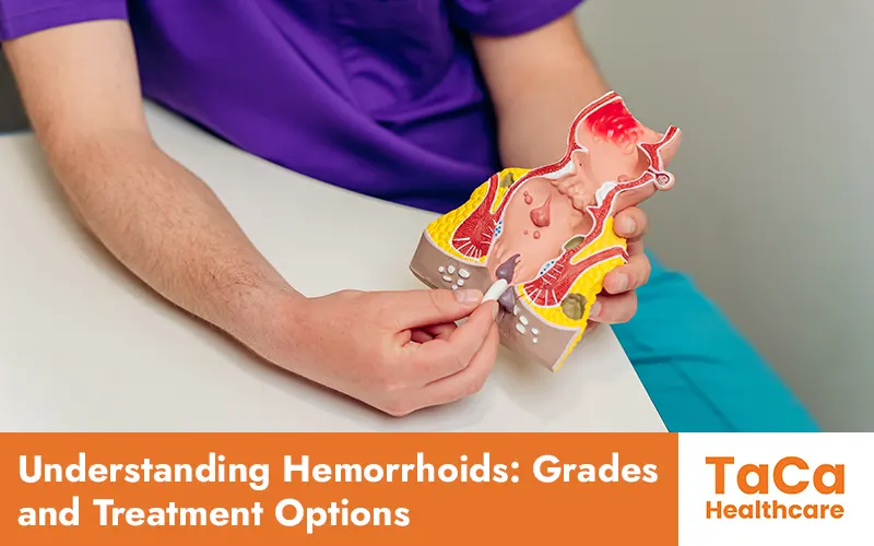 Understanding Hemorrhoids: Grades and Treatment Options